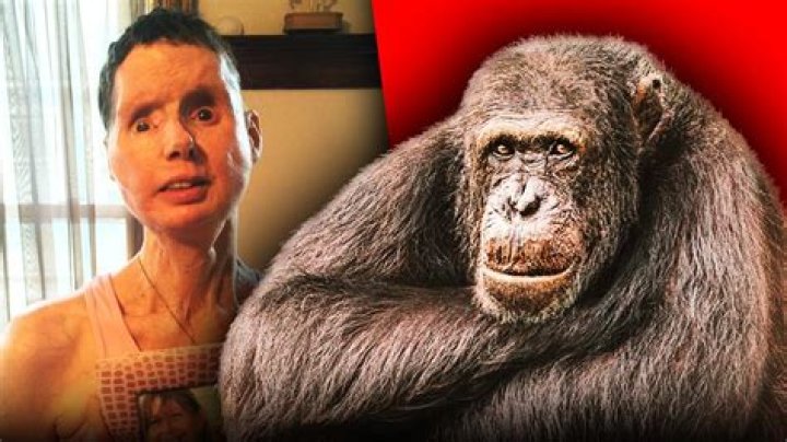 Charla Nash Face Reveal After Getting Attacked By Chimpanzee- Before Surgery Photos And More